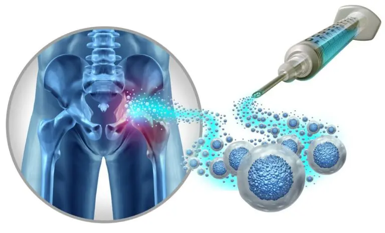 How Can Regenerative Medicine Help Deal With Joint Pain?