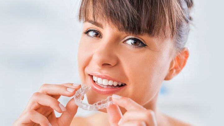 Straight Teeth Aren’t Only About Having a Pretty Smile – The Advantages of Invisalign Braces