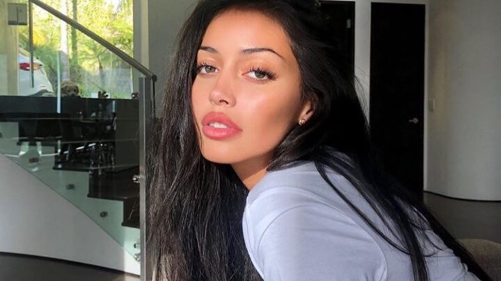 Wolfie Cindy Kimberly Biography: Age, Ethnicity, Net Worth, Full Name, Boyfriend, Zodiac, Eye Color, Skin Care, Surgery, Nationality, Wikipedia