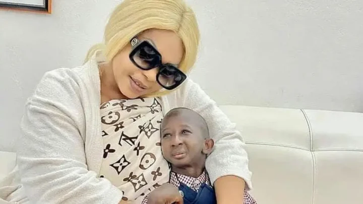 Eudoxie Yao Biography: Music, Age, Instagram, Surgery, Net Worth, Wikipedia, Facebook, Boyfriend