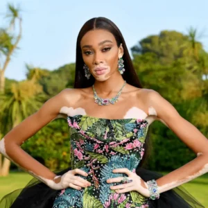 Winnie Harlow