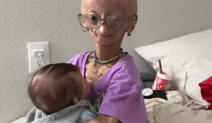 Adalia Rose Biography: Age, Net Worth, Parents, Siblings, Career, Wikipedia, Pictures