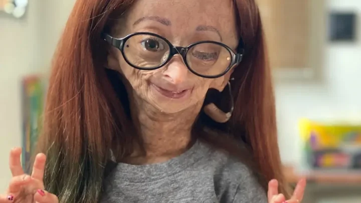 Adalia Rose Biography: Age, Net Worth, Parents, Siblings, Career, Wikipedia, Pictures