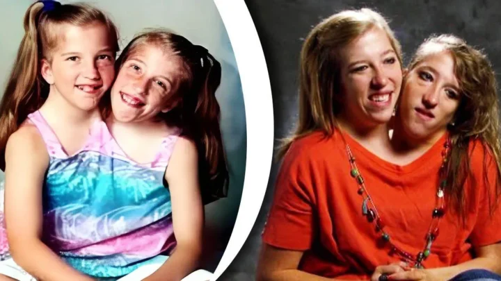 Abby Hensel Biography: Height, Age, Twins, Net Worth, Husband, Siblings, Parents, Children, Books