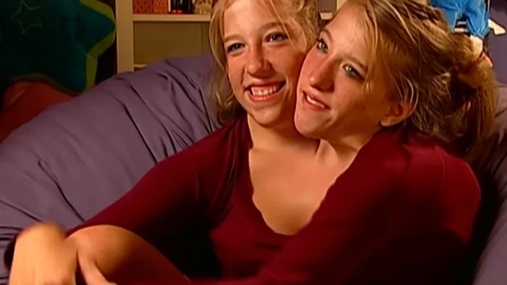 Meet the Conjoined twins Brittany and Abby Hensel