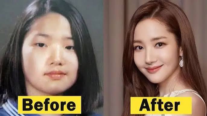 Park Min-young: Embracing Plastic Surgery and Achieving Stardom