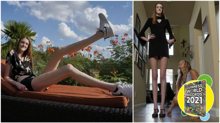 Who Holds the Record for the Longest Legs in the World?