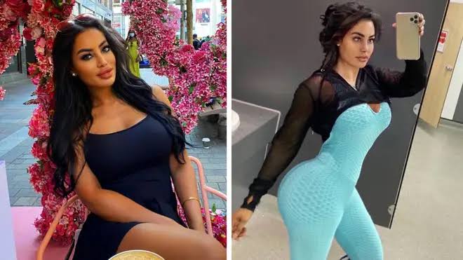 Model Tabby Brown Dies After BBL Surgery Complications