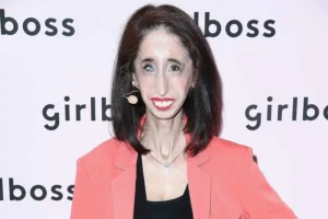 Lizzie Velasquez