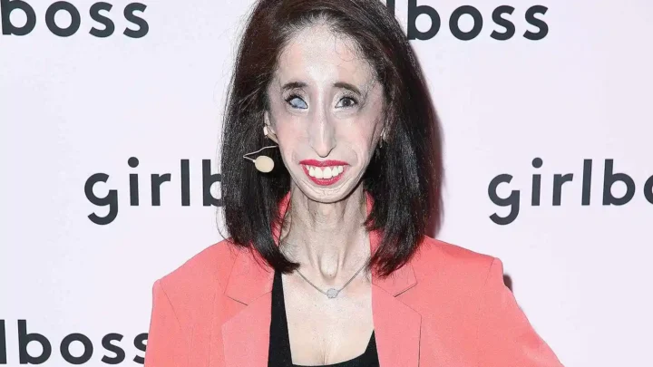 Lizzie Velasquez Bio: Net Worth, Husband, Age, Child, Wedding Photos, Syndrome Condition