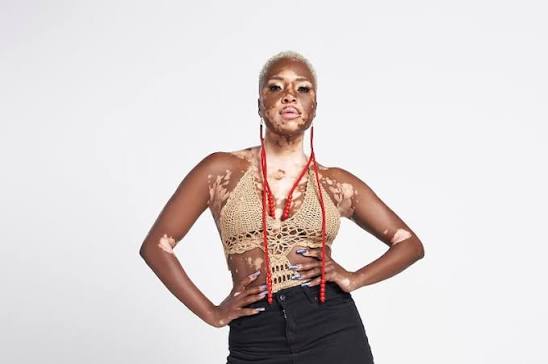 Yolanda Monyai Biography: Age, Net Worth, Siblings, Parents, Height, Ethnicity, Boyfriend, YouTube