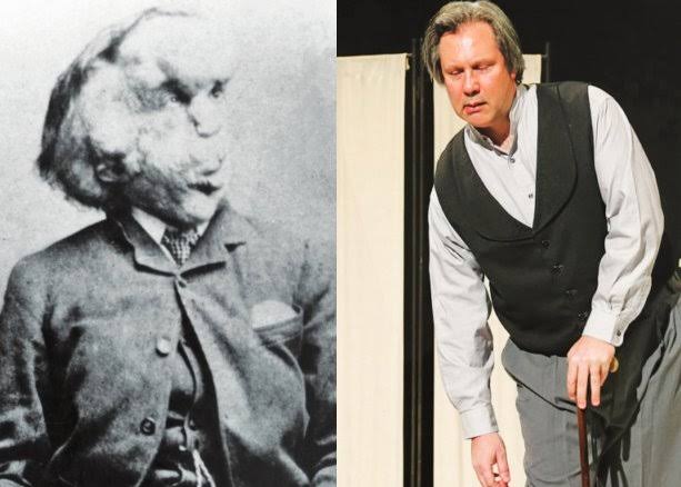 Joseph Merrick Biography: Parents, Siblings, Age, Net Worth, Wikipedia, Education, Career, Death Joseph Merrick Biography: Parents, Siblings, Age, Net Worth, Wikipedia, Education, Career, Death