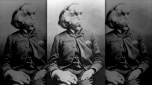 Joseph Merrick