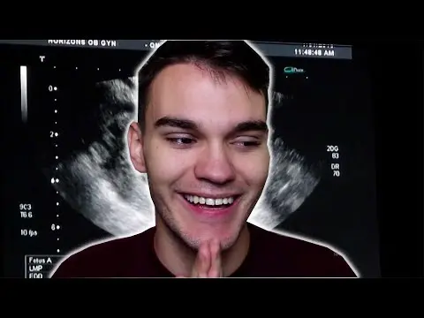 Ivan Magla Biography: Nationality, YouTube, Girlfriend, Height, Net Worth, Age, Instagram Ivan Magla Biography: Nationality, YouTube, Girlfriend, Height, Net Worth, Age, Instagram