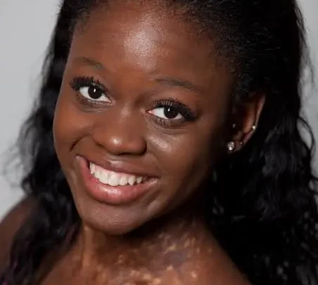 Michaela DePrince Biography: Age, Net Worth, Height, Parents, Career, Husband, Siblings