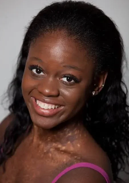 Michaela DePrince Biography: Age, Net Worth, Height, Parents, Career, Husband, Siblings