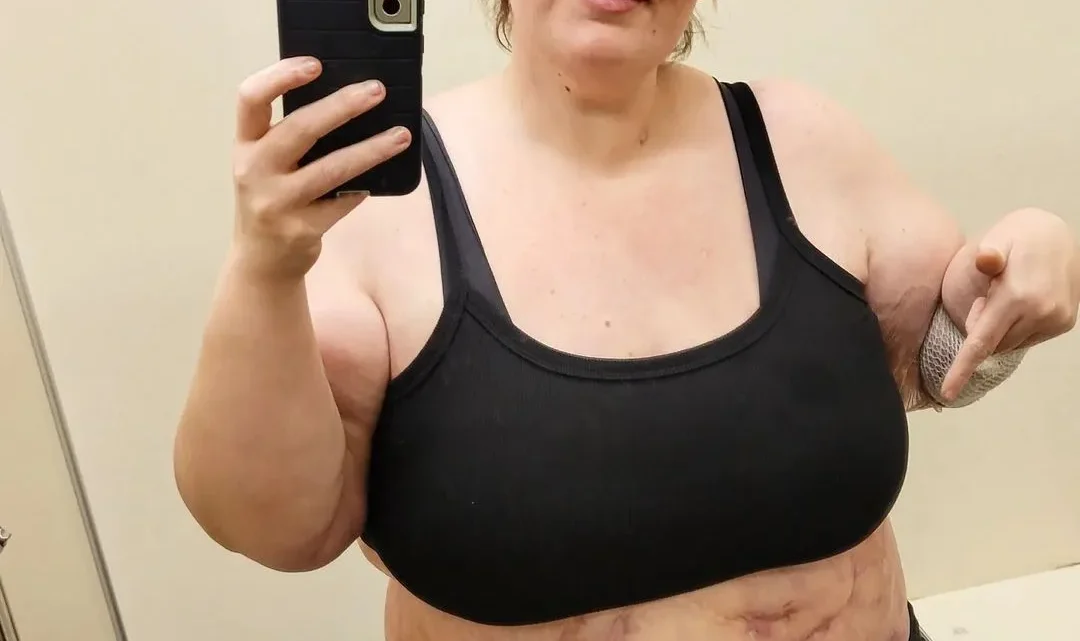 Lexi Reed Biography: Weight Loss, Husband, Age, Net Worth, Height, Calciphylaxis, Journey