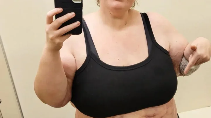 Lexi Reed Biography: Weight Loss, Husband, Age, Net Worth, Height, Calciphylaxis, Journey
