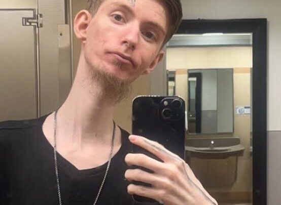 Daddy Long Neck Biography: Age, Net Worth, Son, Partner, Songs, Career, Parents, Height