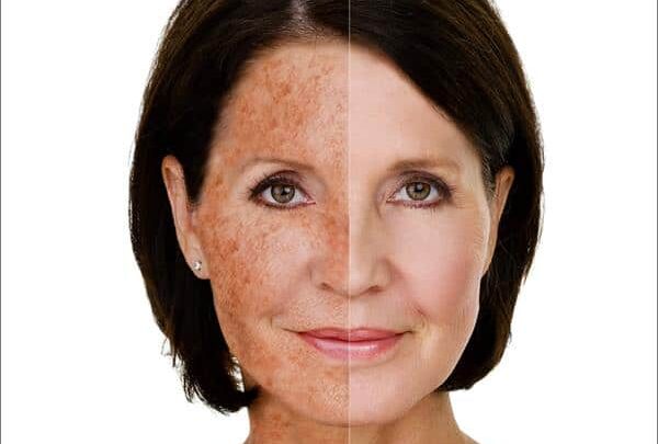 How Sunscreen Use Over a Lifetime Affects Skin Aging in Measurable Ways