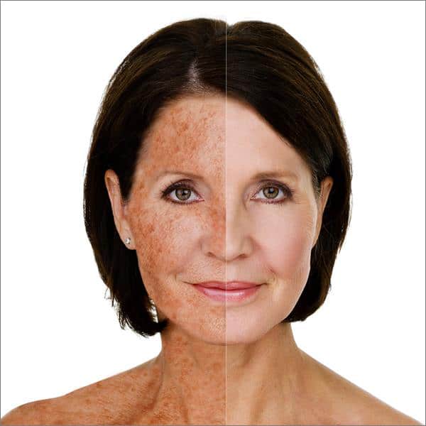 How Sunscreen Use Over a Lifetime Affects Skin Aging in Measurable Ways