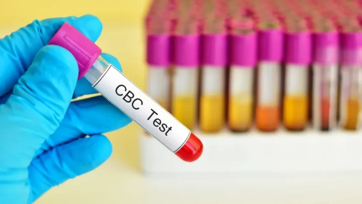 What a Complete Blood Count (CBC) Actually Tells Your Doctor About Your Health