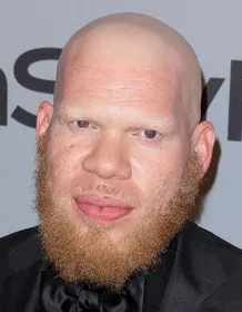 Krondon - Biography