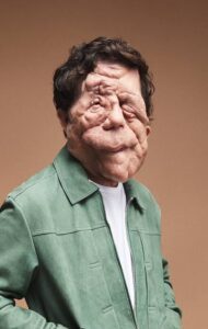 Adam Pearson - Biography