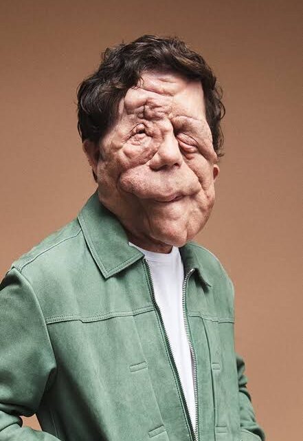 Adam Pearson Biography: Awards, Age, Height, Net Worth, Siblings,  Girlfriend, Movies, TV Shows, Health Condition, Twitter