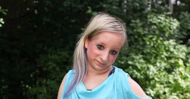 Hannah Kritzeck Biography: Age, Net Worth, Movies, Parents, Surgery, Ethnicity, Boyfriend, Religion