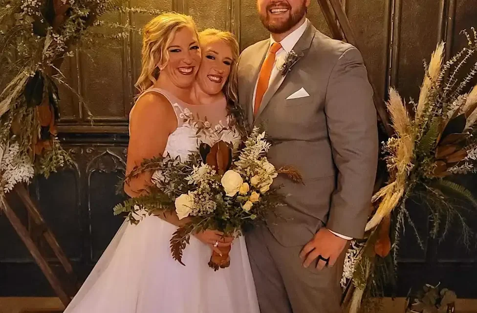 Who is Josh Bowling? Abby Hensel’s husband Bio: Age, Wife, Parents, Net Worth, Height, Children