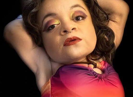 Pamela Chavez Biography: Age, Height, Husband, Parents, Siblings, Net Worth, Jay & Pamela, Disability Advocacy